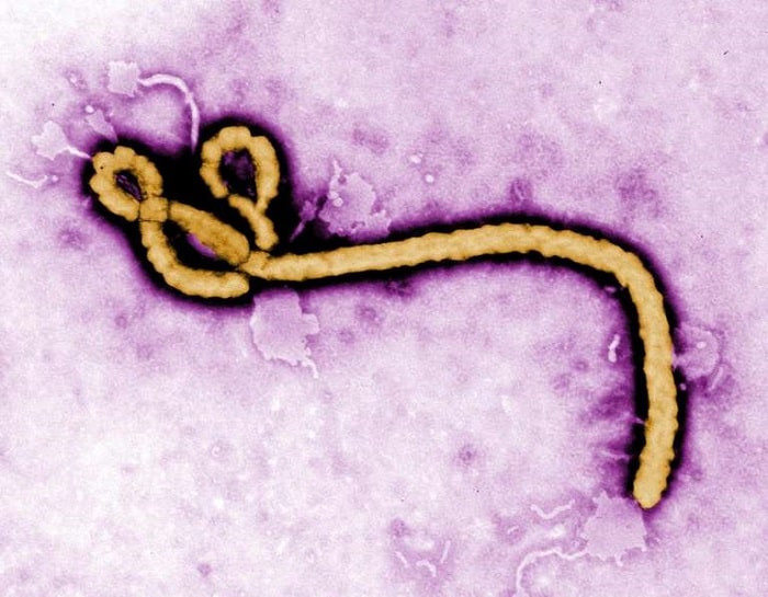 épidémie d’Ebola/virus Ebola