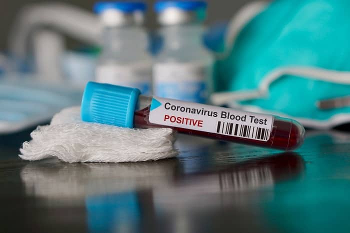 covid-19-vaccin/Coronavirus-OMS